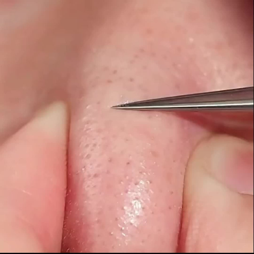 1 Pack Extra Fine No. 5 Blackhead Tweezers - Facial Beauty Remove