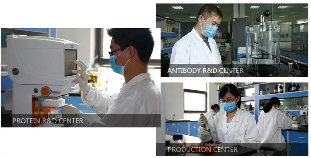 Elisa Kit for Rat Phosphoenolpyruvate Carboxykinase(PEPCK) ELISA Kit